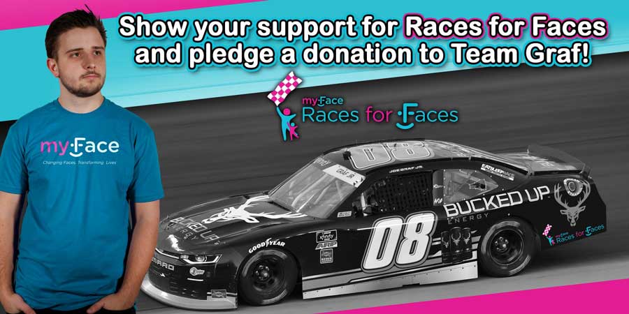 Show your support for Races for Faces and pledge a donation to Team Graf!